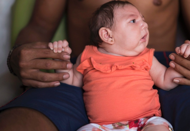 brazil-zika-birth-defects